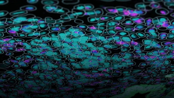 Image20260219-tonguecancer